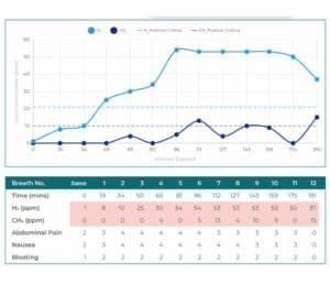 IBS and SIBO Test